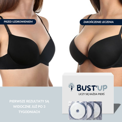 BUST'UP – PLASTER DO POWIĘKSZANIA PIERSI
